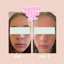 Load image into Gallery viewer, My First Skincare Routine | Confetti